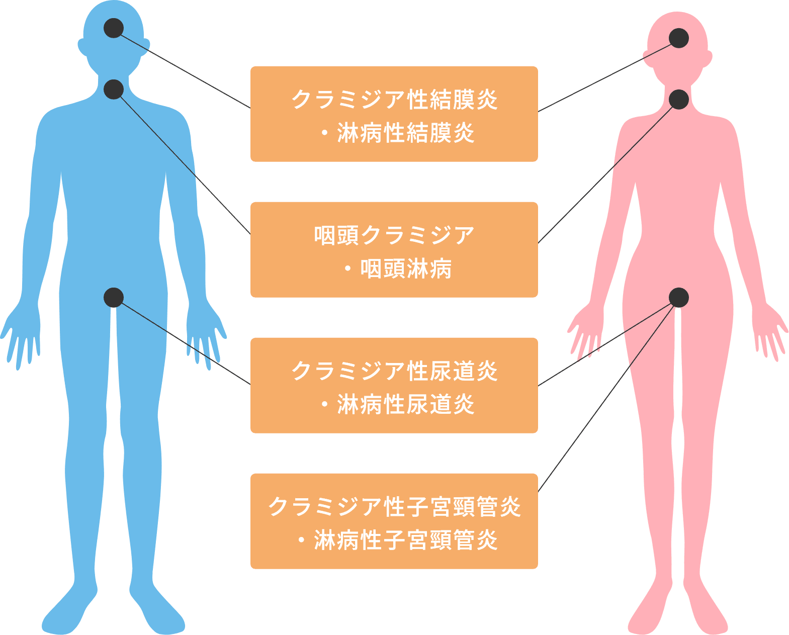 頭：クラミジア性結膜炎・淋病性結膜炎、首：咽頭クラミジア・咽頭淋病、尿道：クラミジア性尿道炎・淋病性尿道炎、子宮：クラミジア性子宮頸管炎・淋病性子宮頸管炎